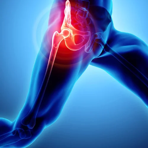 Hip Pain in Adults: Causes and Treatments