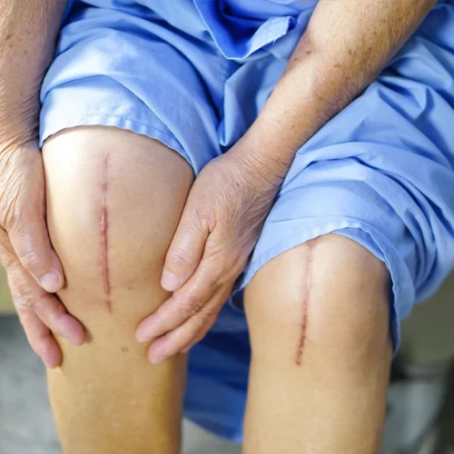 7 Proven Ways to Prevent Knee Pain and Injuries