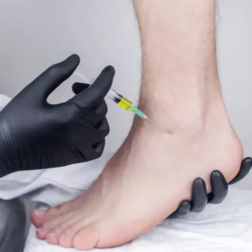 Non-Surgical Treatment