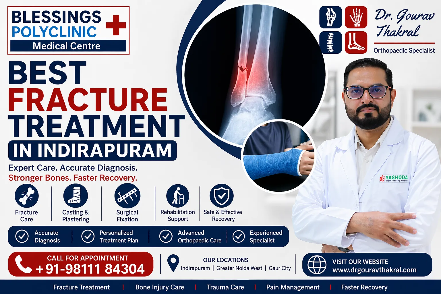 Best Fracture Treatment in Indirapuram