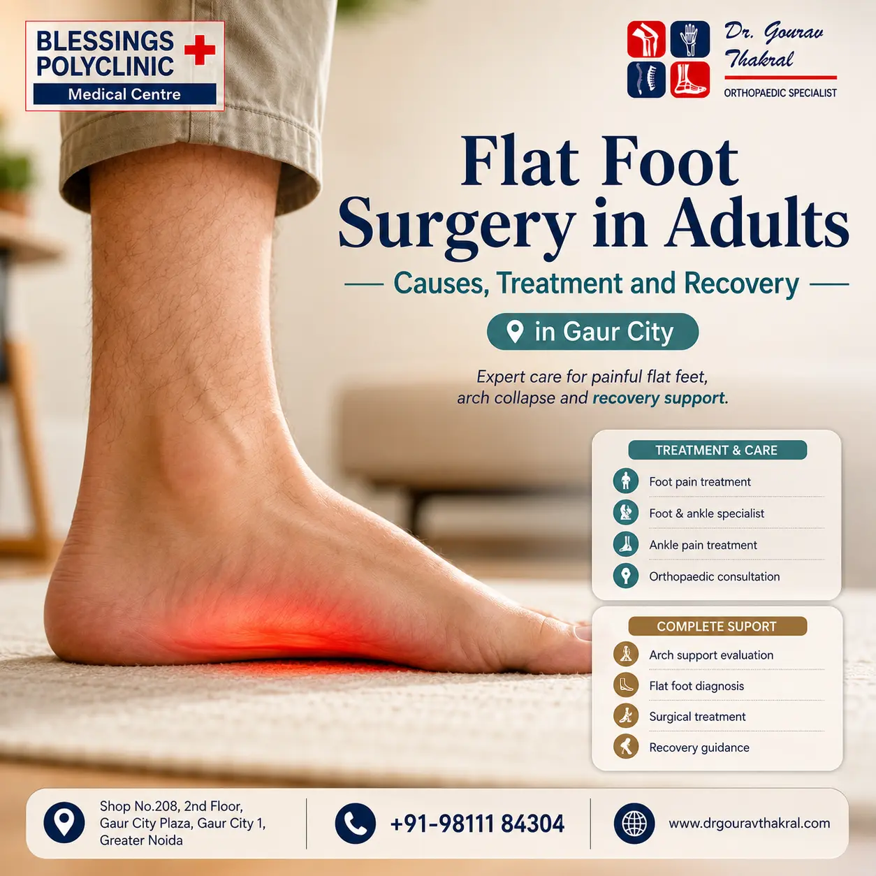 Flat Foot Surgery in Adults: Causes, Treatment and Recovery in Gaur City