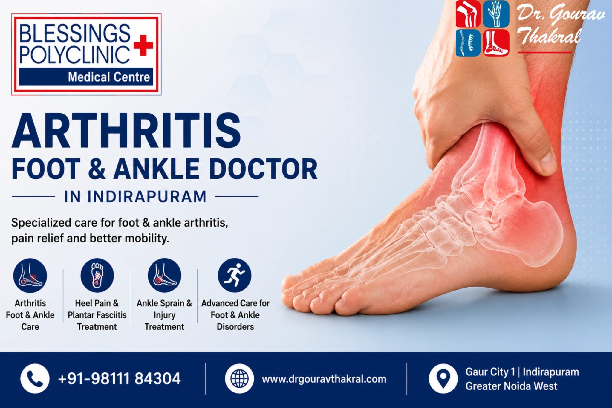 Arthritis Foot & Ankle Doctor in Indirapuram