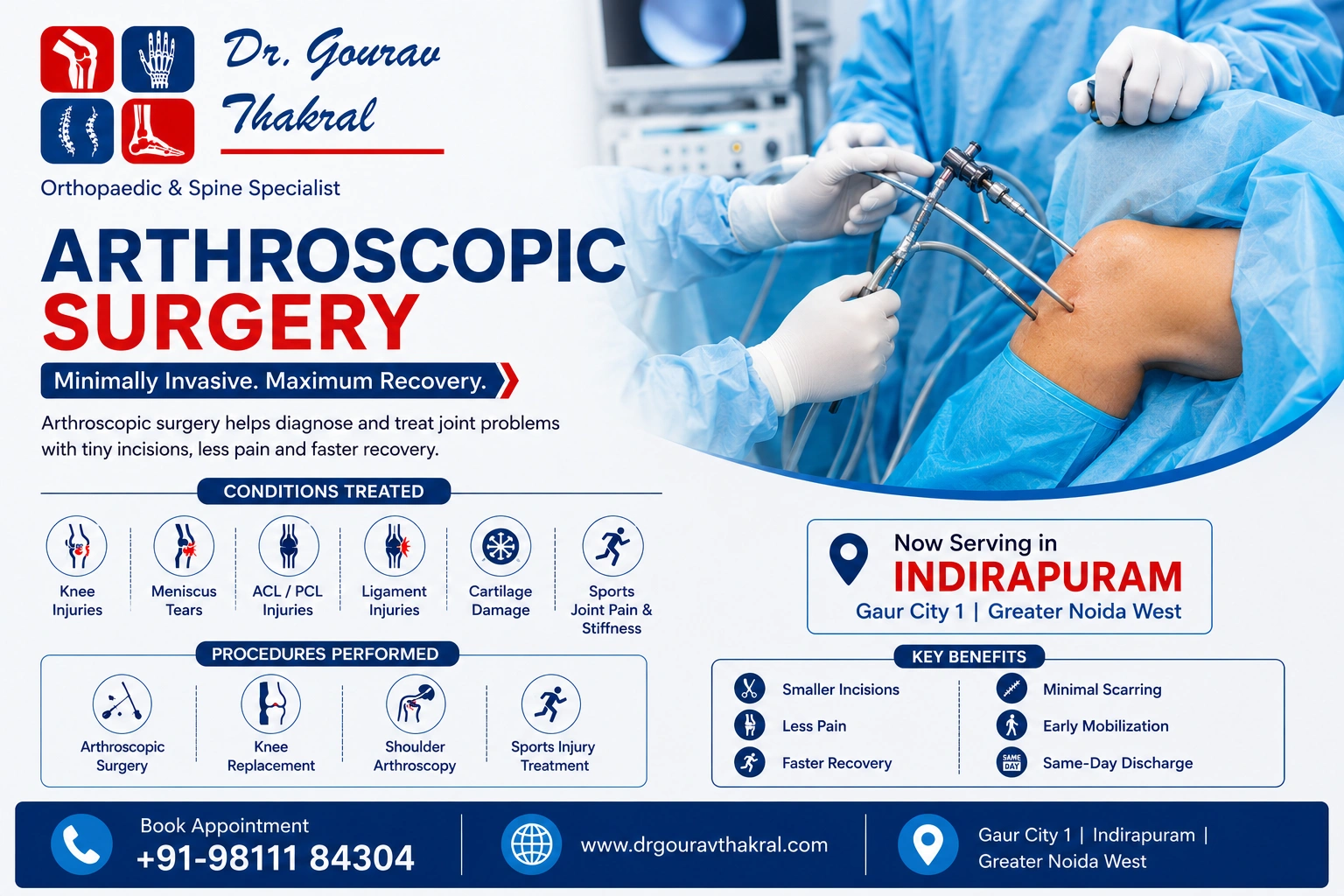 Best Arthroscopic Surgery in Indirapuram