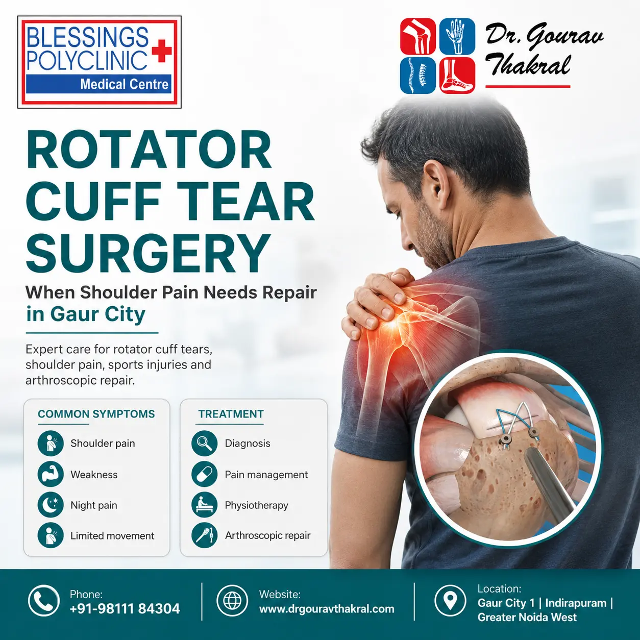 Rotator Cuff Tear Surgery in Gaur City: When Shoulder Pain Needs Repair