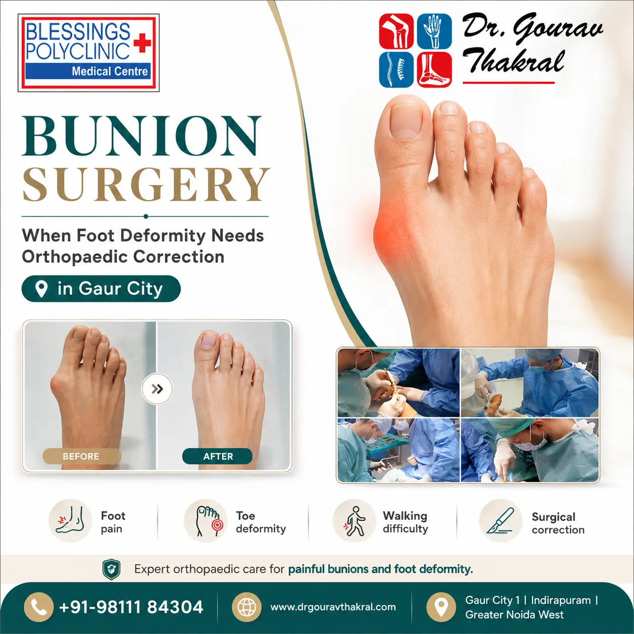 Bunion Surgery in Gaur City: Foot Deformity Correction by Orthopaedic Specialist