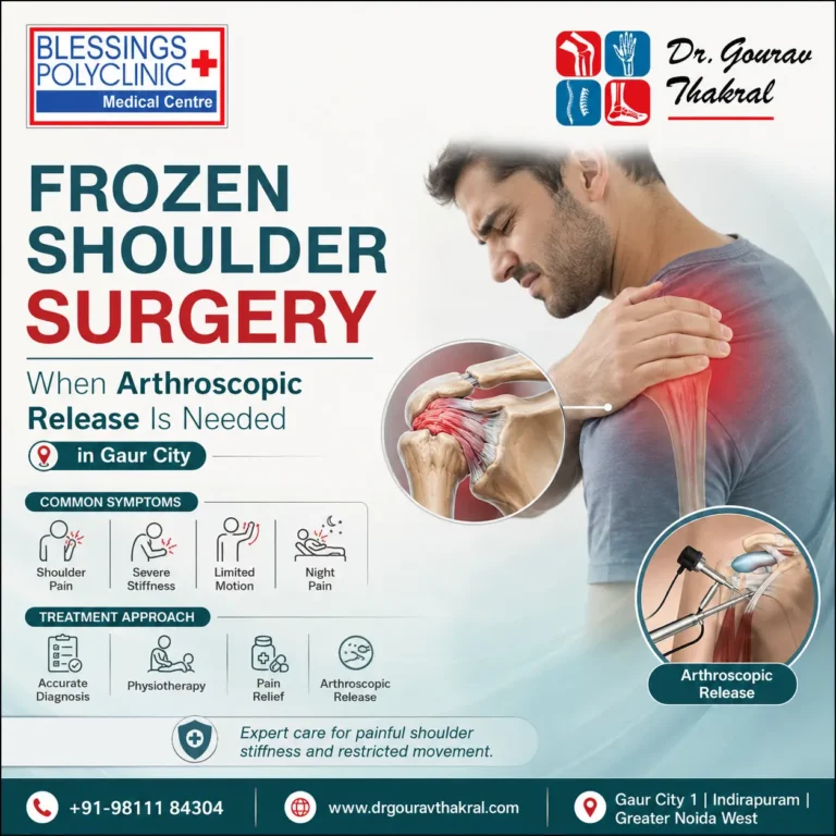 Frozen Shoulder Surgery in Gaur City: When Arthroscopic Release Is Needed