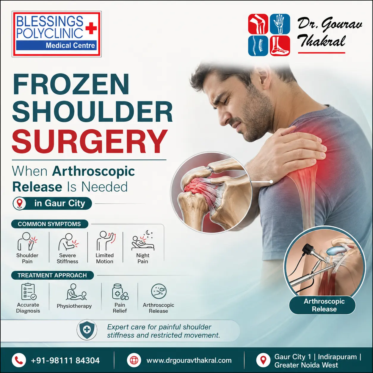 Frozen Shoulder Surgery in Gaur City: Arthroscopic Release for Severe Shoulder Stiffness