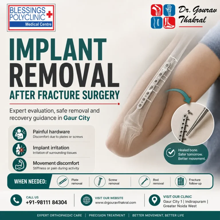 Implant Removal Surgery in Gaur City: When Fracture Hardware Needs Removal
