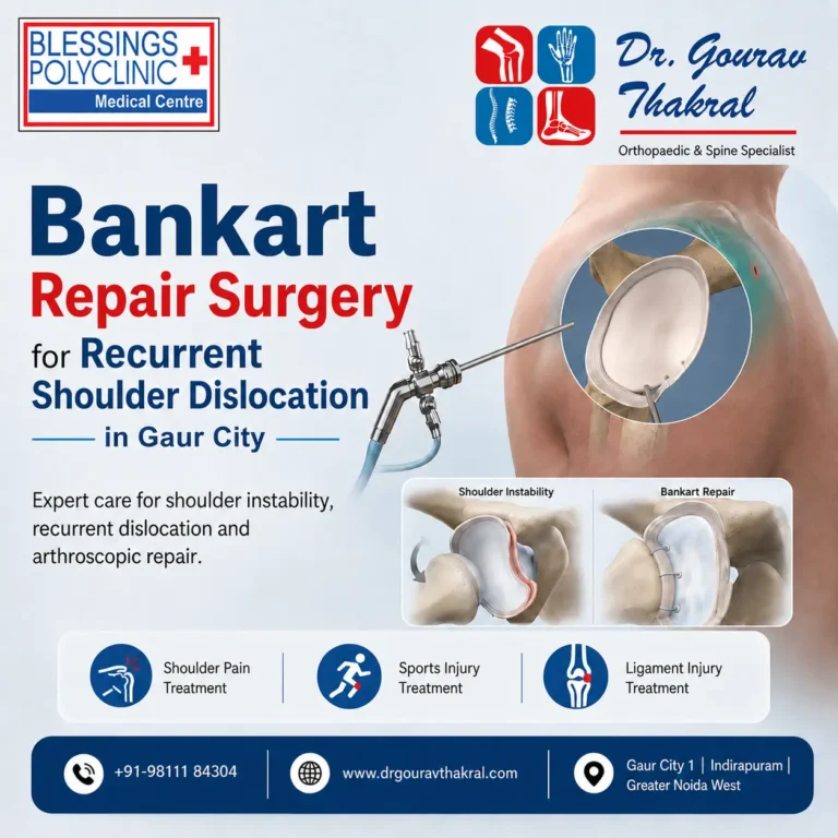 Bankart Repair Surgery in Gaur City for Recurrent Shoulder Dislocation