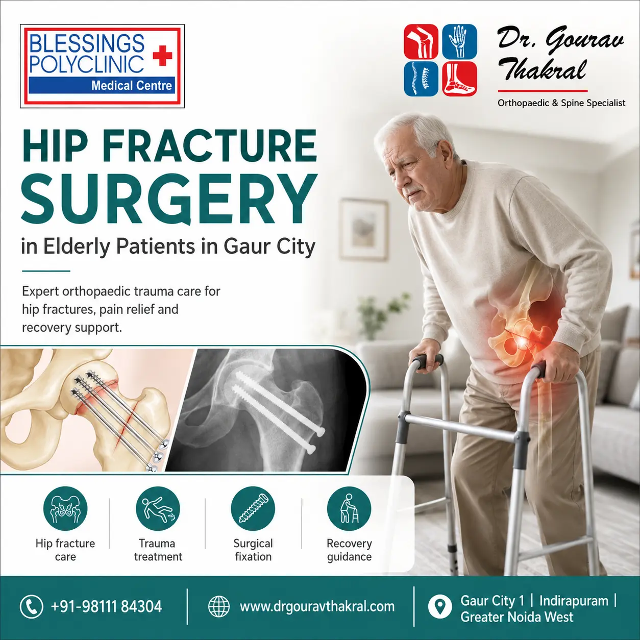 Hip Fracture Surgery in Gaur City: Expert Care for Elderly Patients