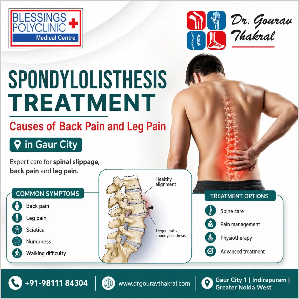 Spondylolisthesis Treatment in Gaur City: Causes of Back Pain and Leg Pain