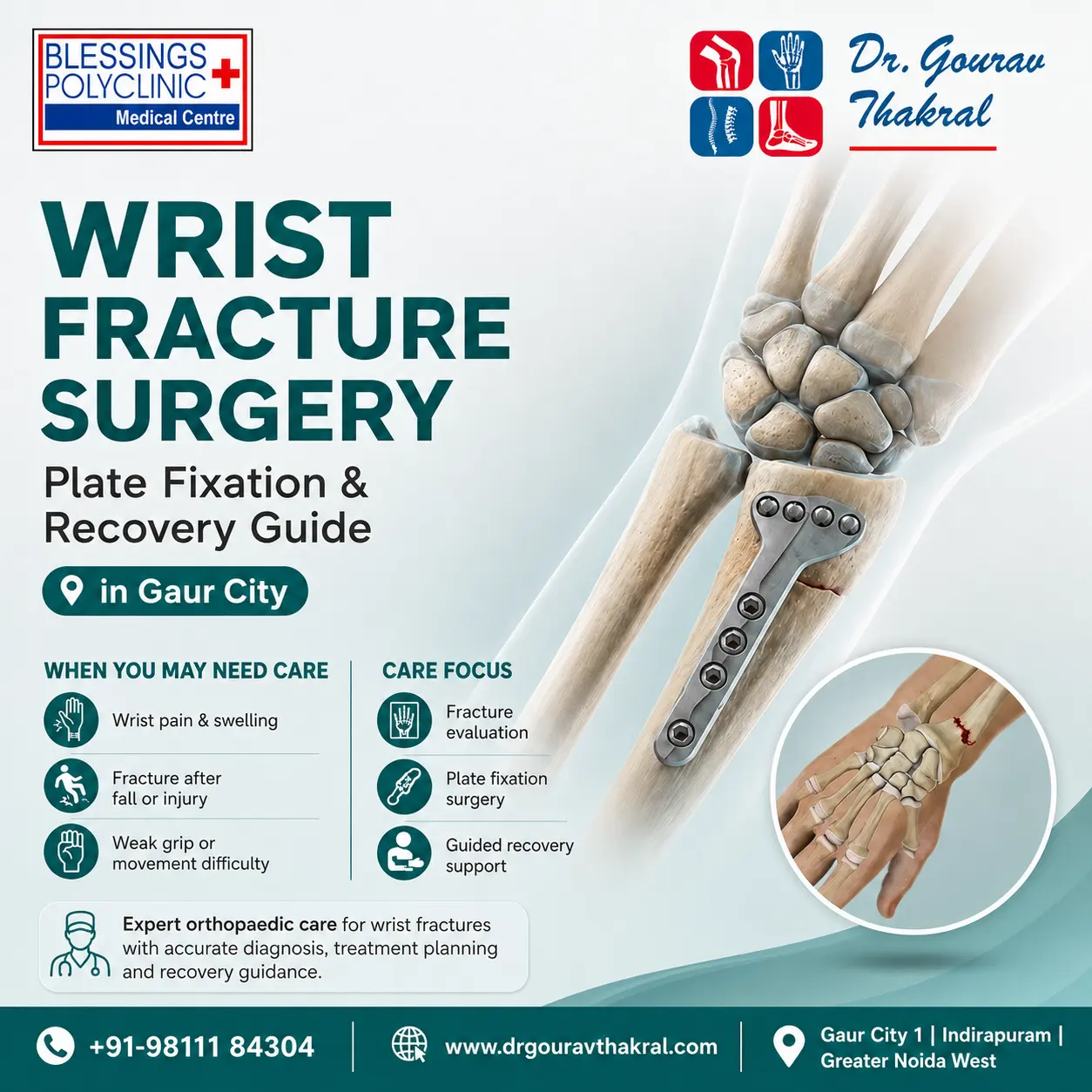 Wrist Fracture Surgery in Gaur City: Plate Fixation and Recovery Guide