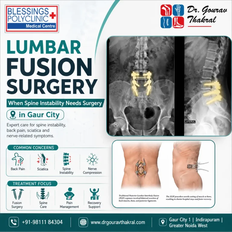 lumbar fusion surgery