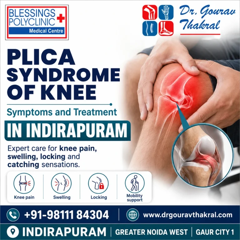 Plica Syndrome of Knee Treatment in Indirapuram