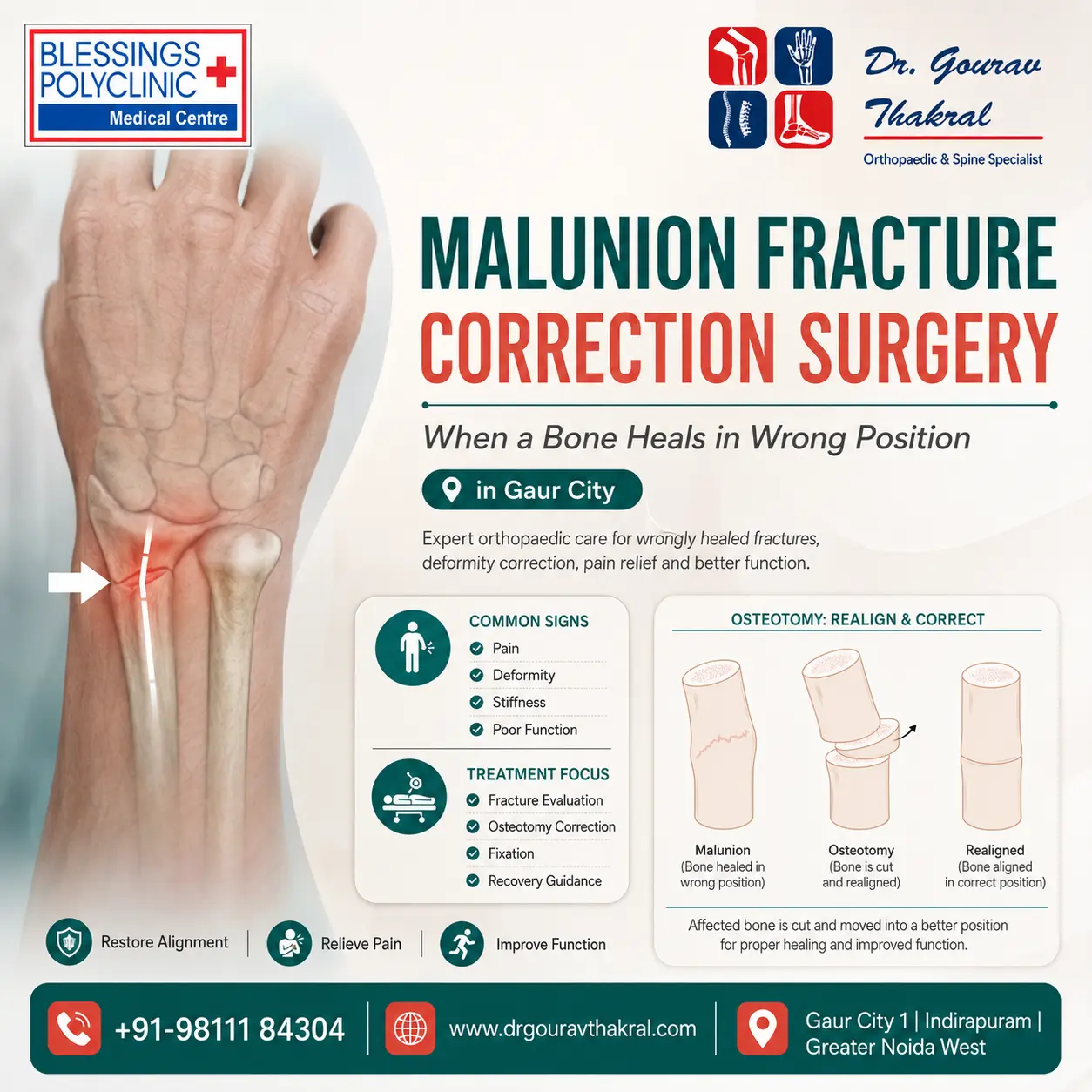 Malunion Fracture Correction Surgery in Gaur City: Bone Healed Wrong?