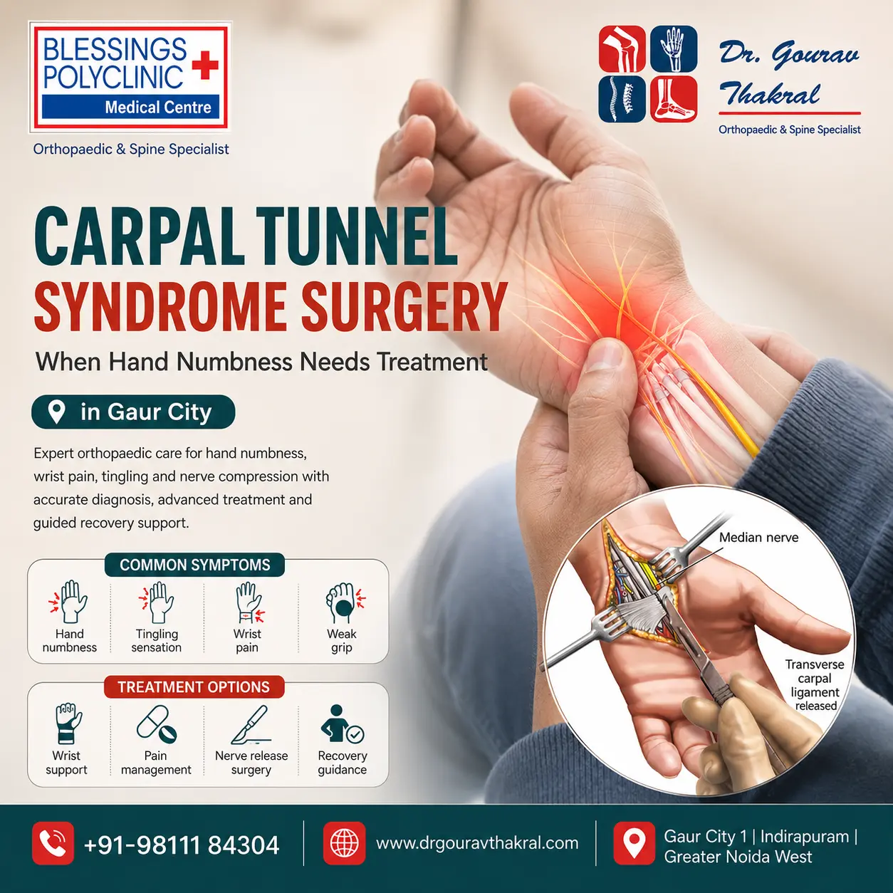 Carpal Tunnel Syndrome Surgery in Gaur City: When Hand Numbness Needs Treatment