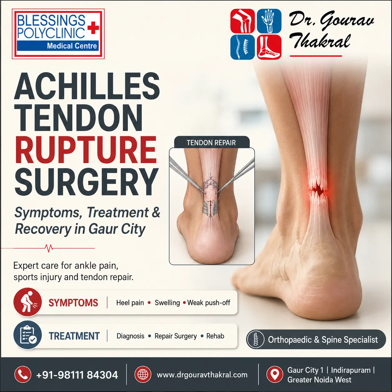 Achilles Tendon Rupture Surgery in Gaur City: Symptoms, Treatment and Recovery