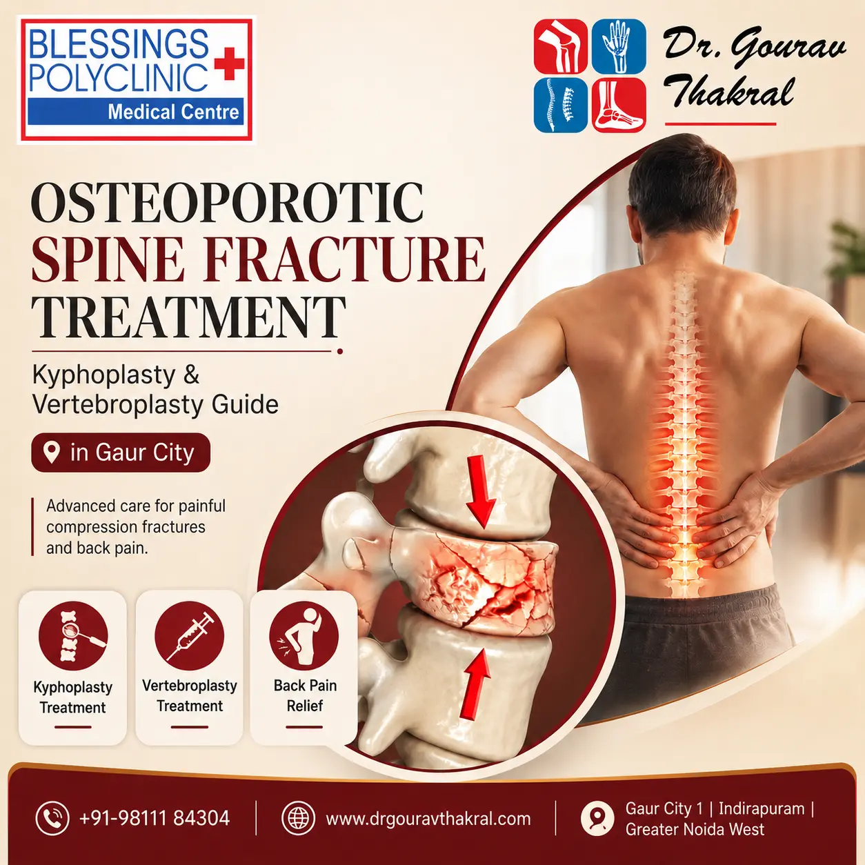 Osteoporotic Spine Fracture Treatment in Gaur City: Kyphoplasty and Vertebroplasty Guide