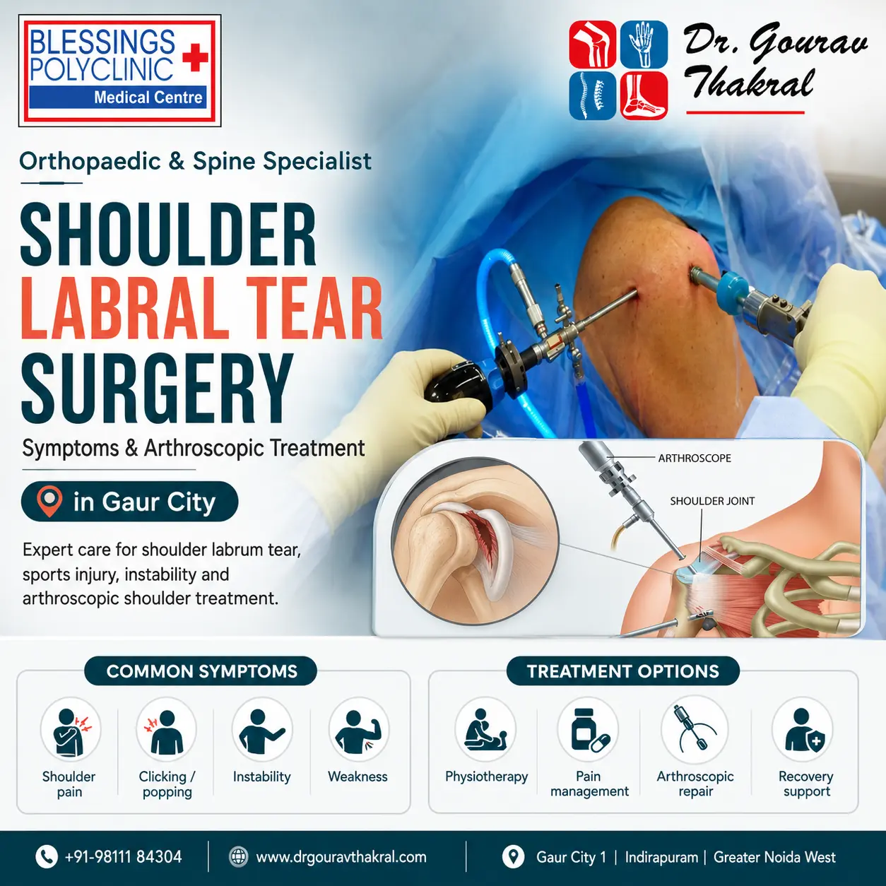 Shoulder Labral Tear Surgery in Gaur City: Symptoms and Arthroscopic Treatment