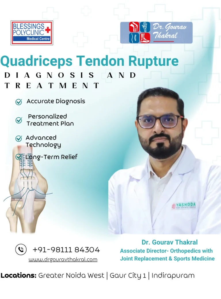 Quadriceps Tendon Rupture: Diagnosis and Treatment in Indirapuram