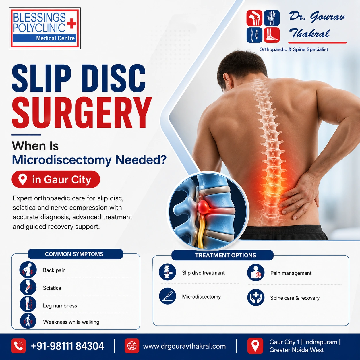 Slip Disc Surgery in Gaur City: When Is Microdiscectomy Needed?
