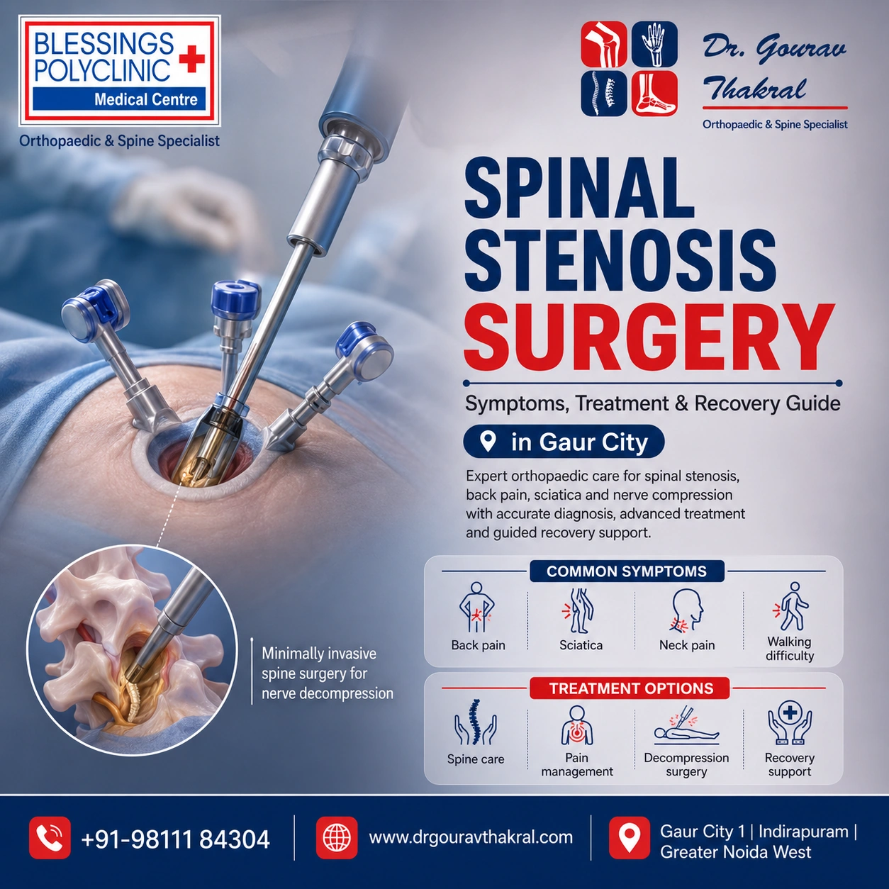 Spinal Stenosis Surgery