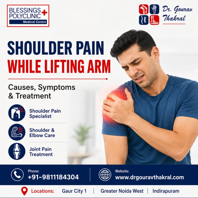Shoulder Pain While Lifting Arm