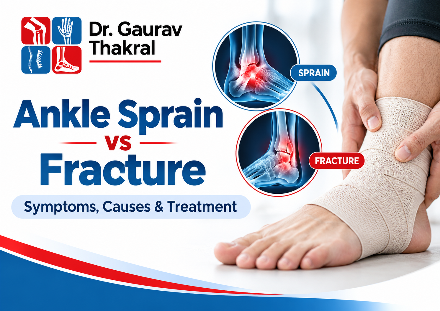 Ankle Sprain vs Fracture: Symptoms, Causes & Treatment in Greater Noida West
